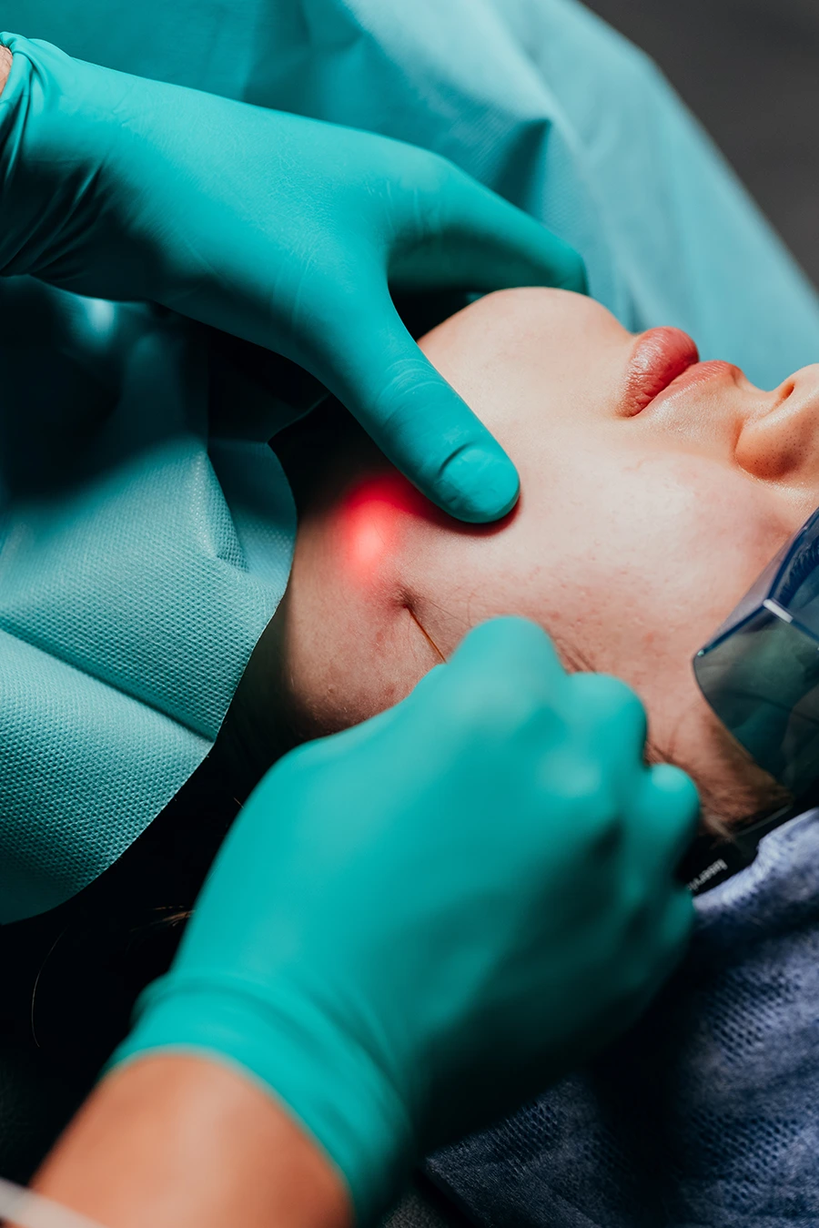 doc-Rawi_SPH_Lippen_Endolift