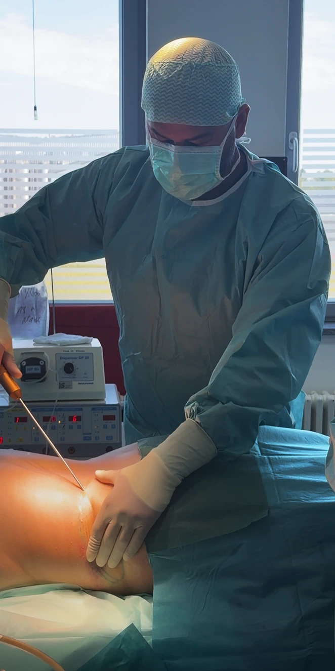 Rawi Bekeran bei einer Liposuktion